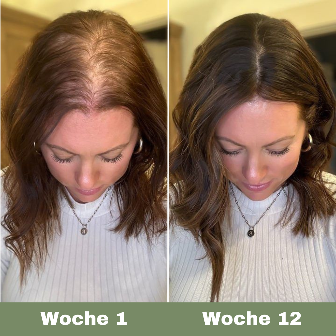 Veganes Haaröl für schnelles Wachstum